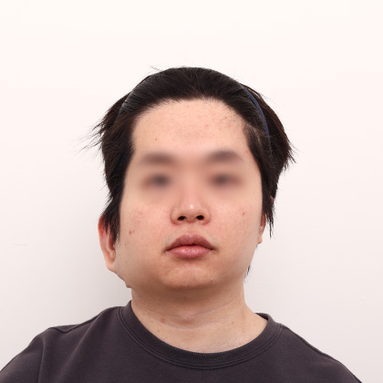 After
